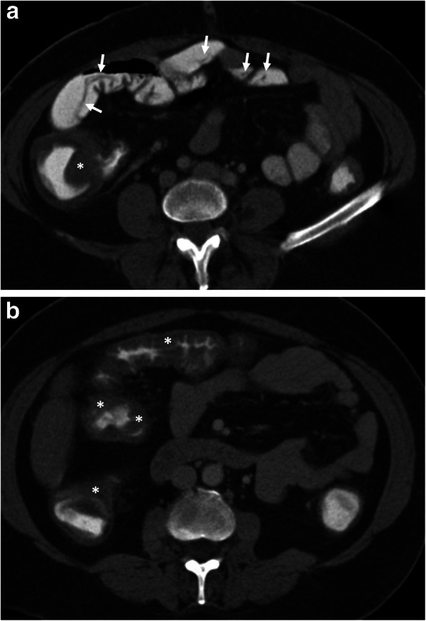 Fig. 13