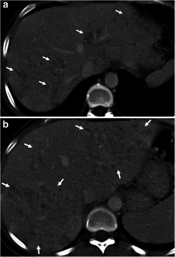 Fig. 10