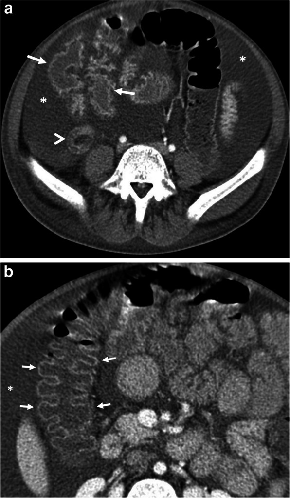 Fig. 14