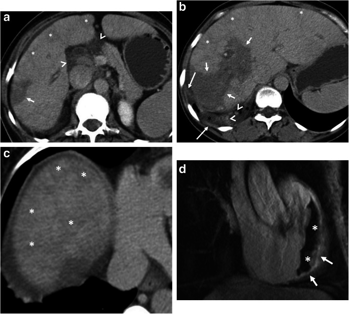 Fig. 12