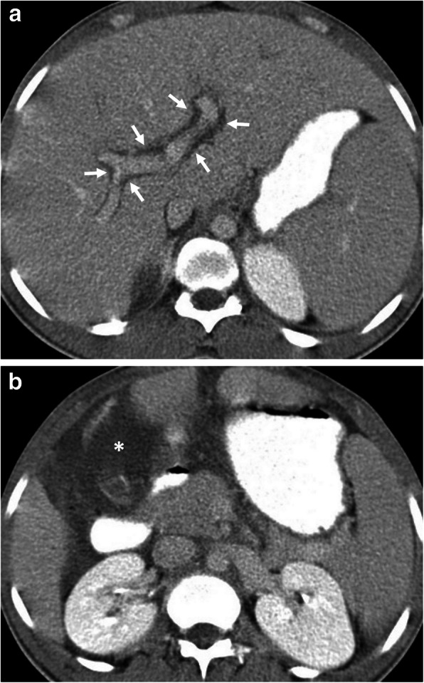 Fig. 17