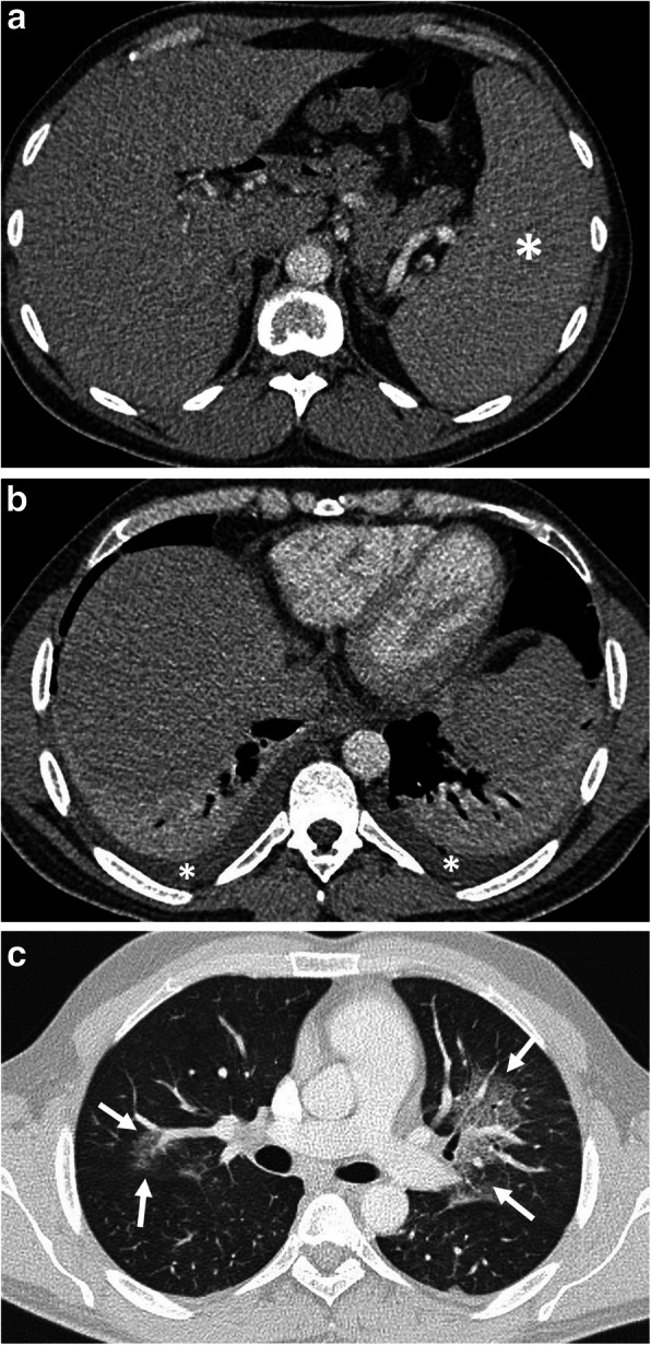 Fig. 15