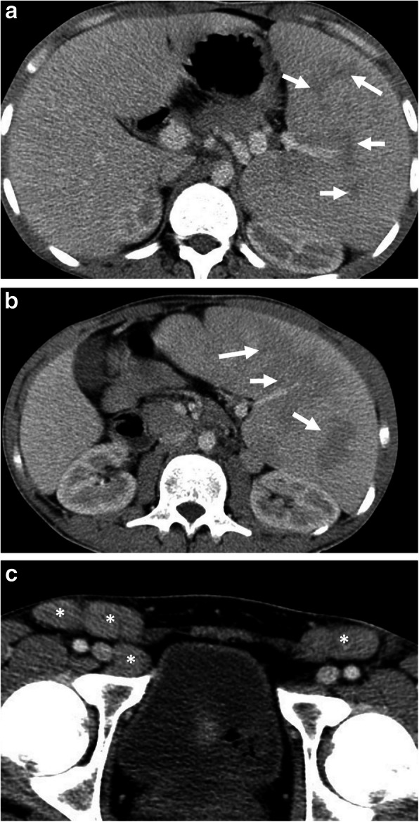 Fig. 16