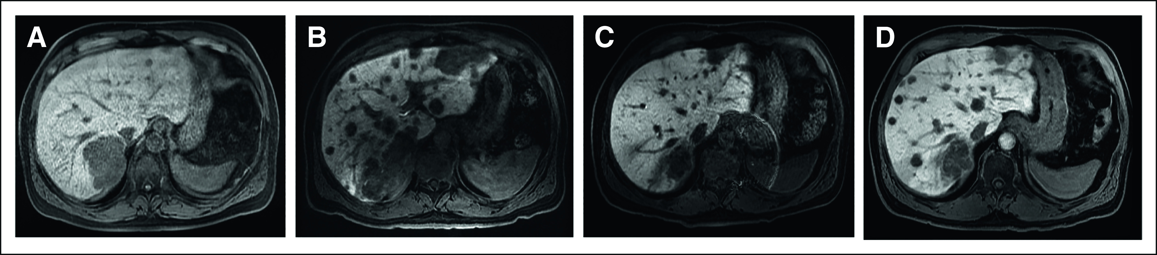 FIG 2.