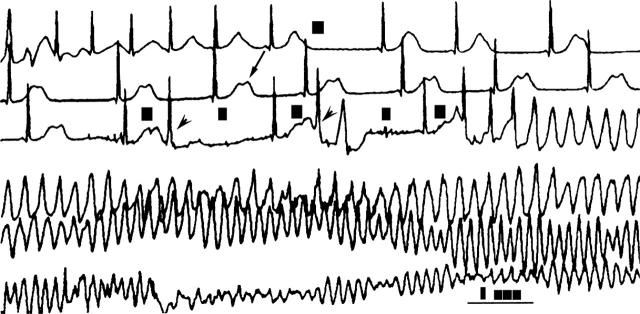 Figure 1  