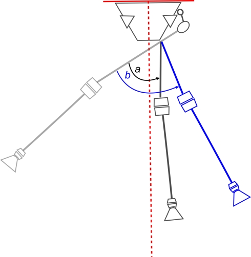 The pelvic support osteotomy: indications and preoperative planning - PMC