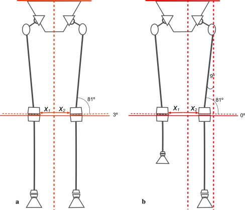 The pelvic support osteotomy: indications and preoperative planning - PMC