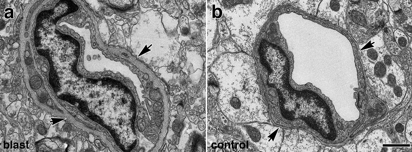 Fig. 14