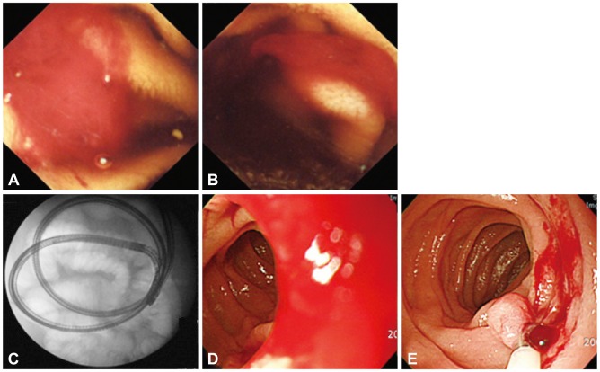 Fig. 2