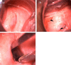 Fig. 1