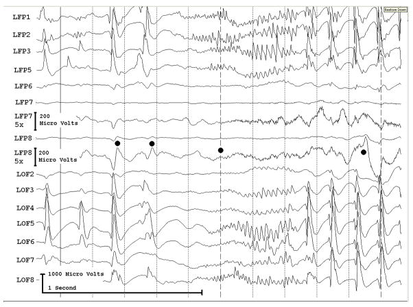 Fig. 3