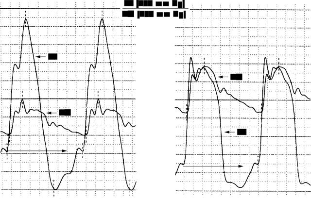 Figure 2  