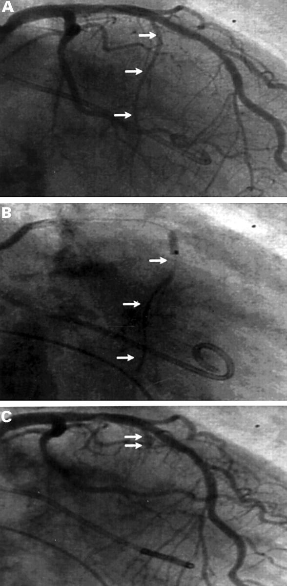 Figure 1  