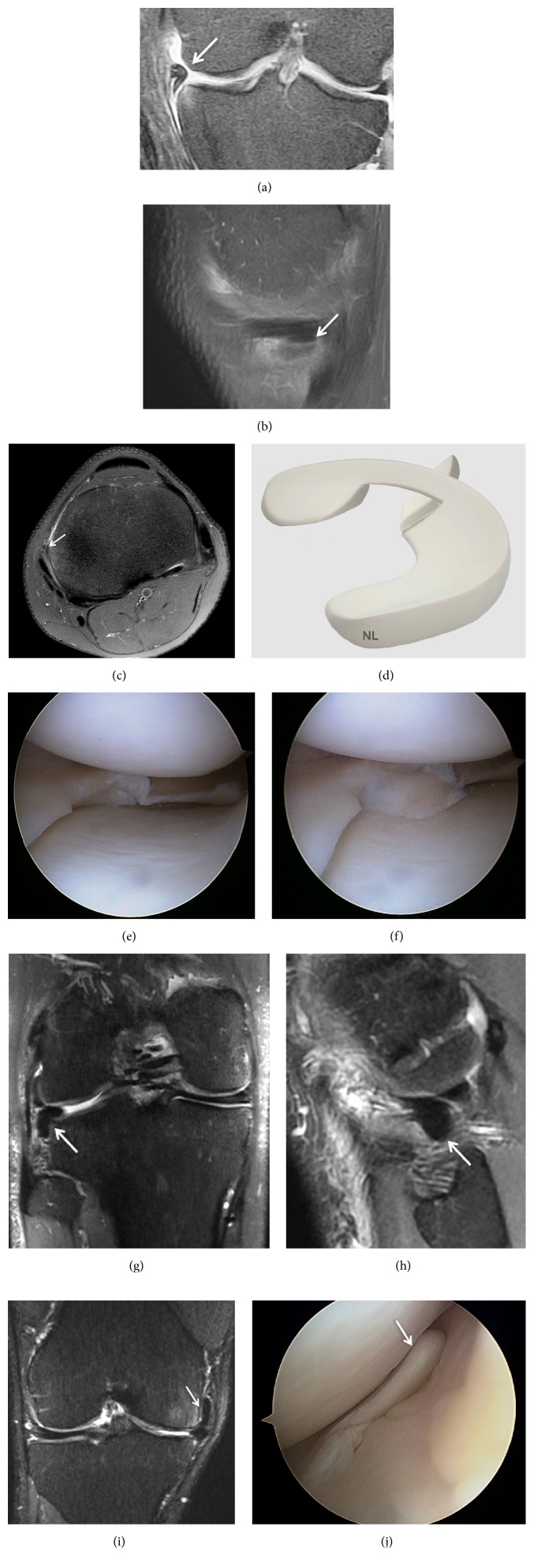 Figure 14