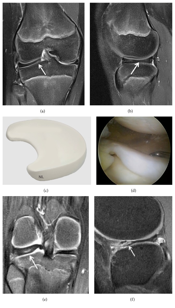 Figure 16