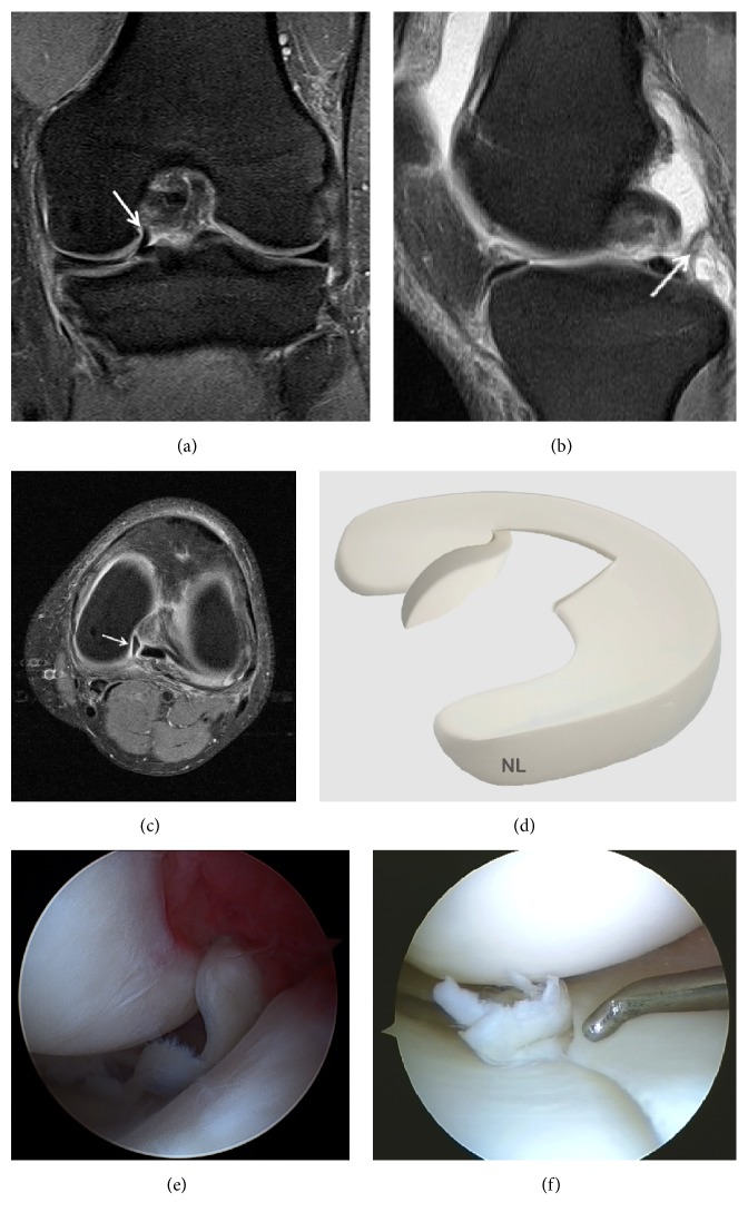 Figure 13