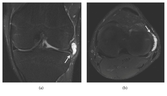 Figure 15