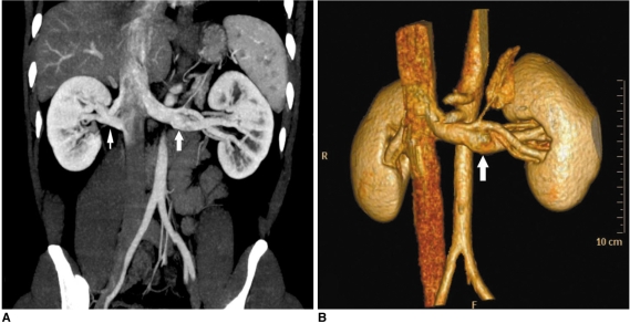 Fig. 15