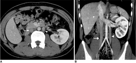 Fig. 14