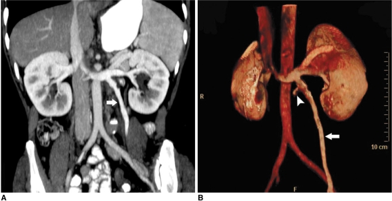 Fig. 16