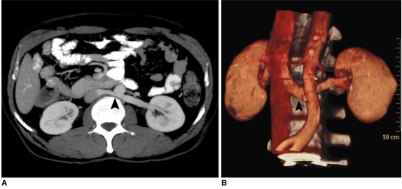 Fig. 13