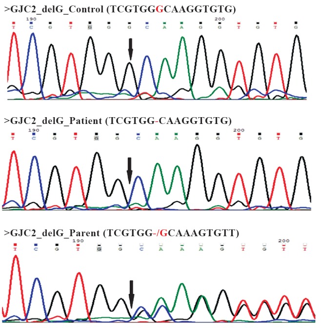 Figure B