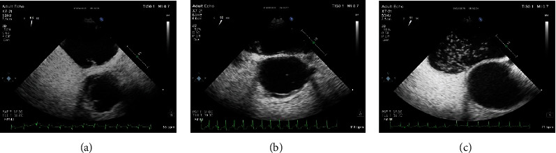 Figure 2