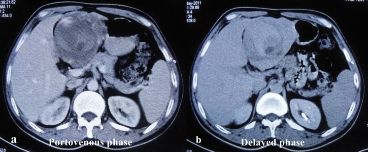 Figure 3