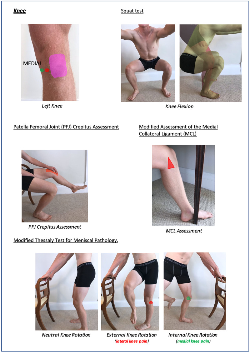 Figure 22