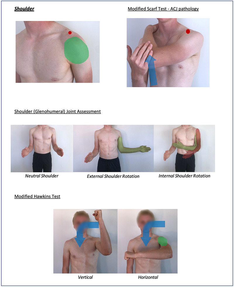 Figure 18