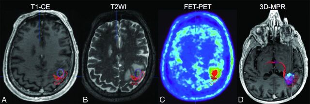 Fig 1.