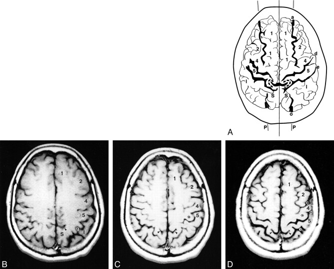 fig 3.