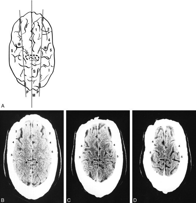 fig 6.