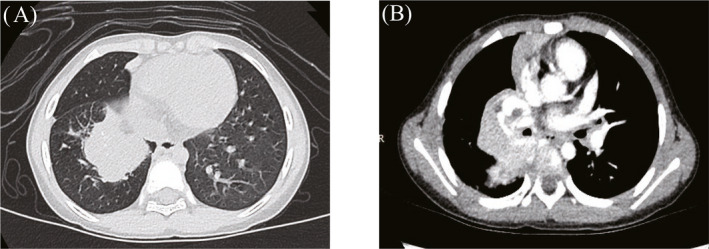 FIGURE 2