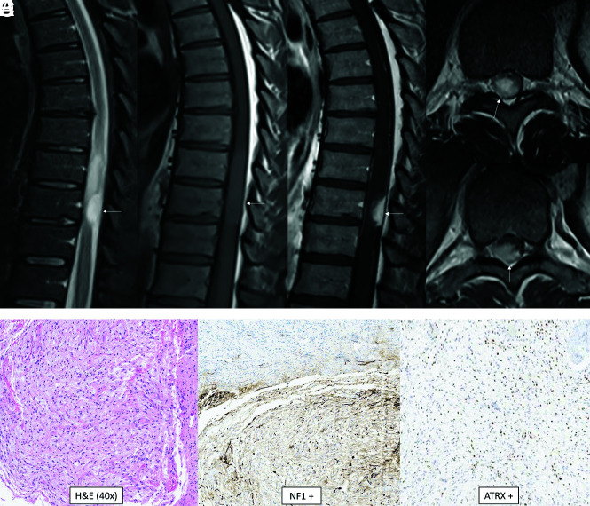 FIG 6.