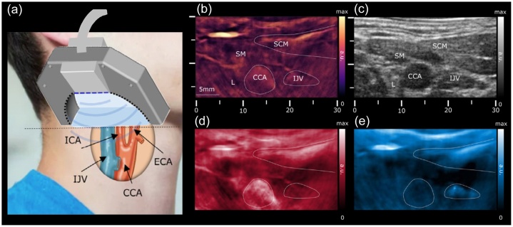 Fig. 11