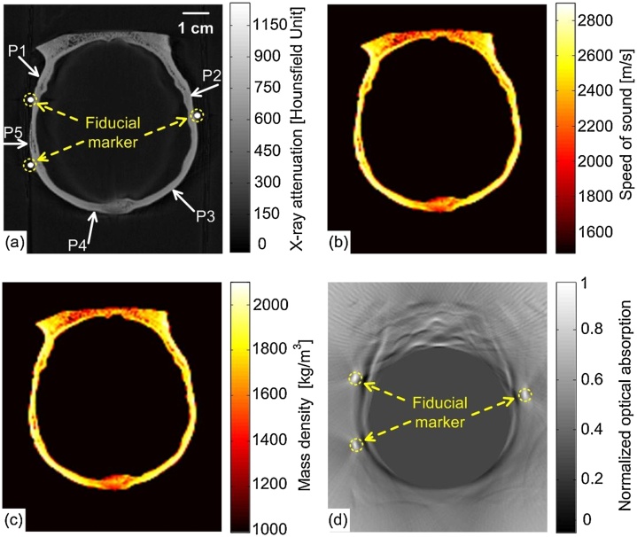 Fig. 13