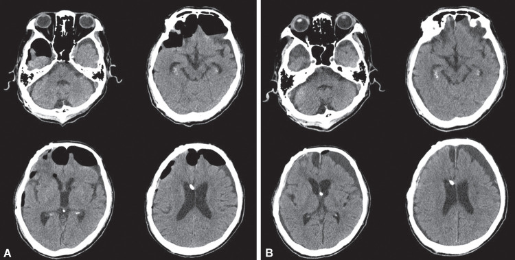 Figs 3A and B