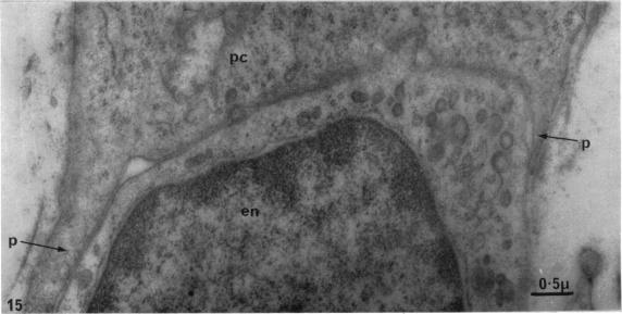 Fig. 15