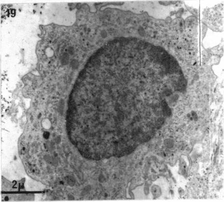 Fig. 19