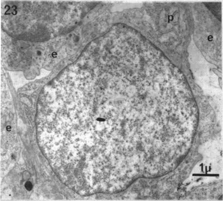 Fig. 23