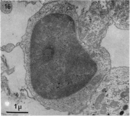 Fig. 16