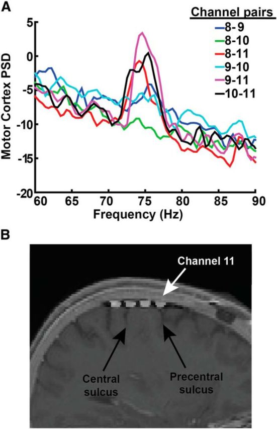 Figure 13.