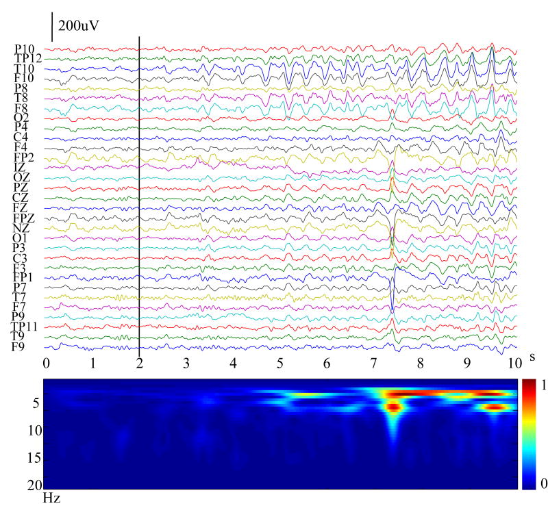 Figure 1