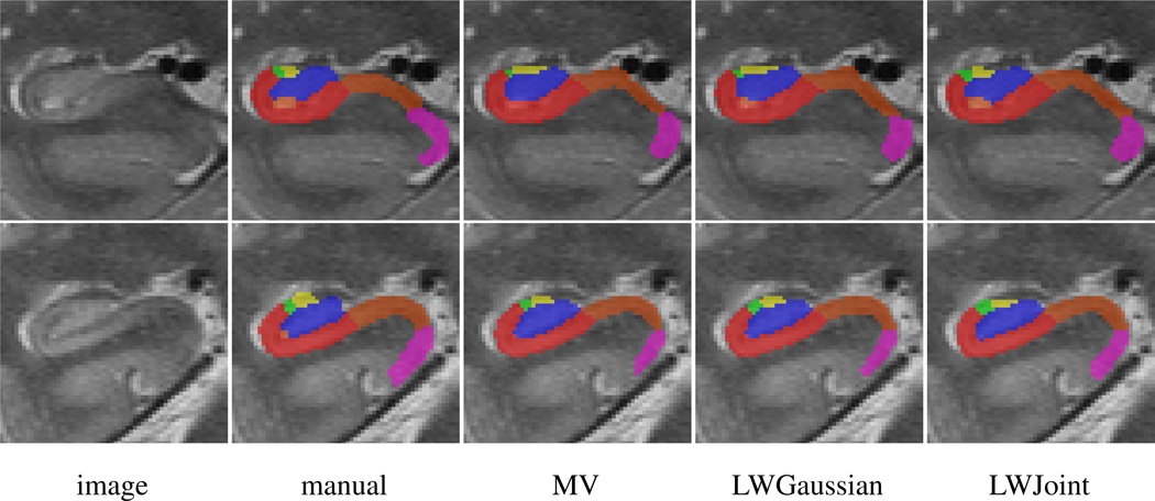 Fig. 4