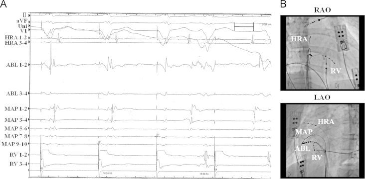 Fig. 3