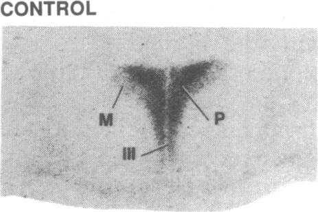 graphic file with name pnas00242-0328-b.jpg