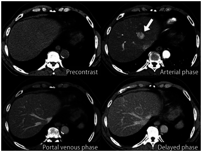 Fig. 6