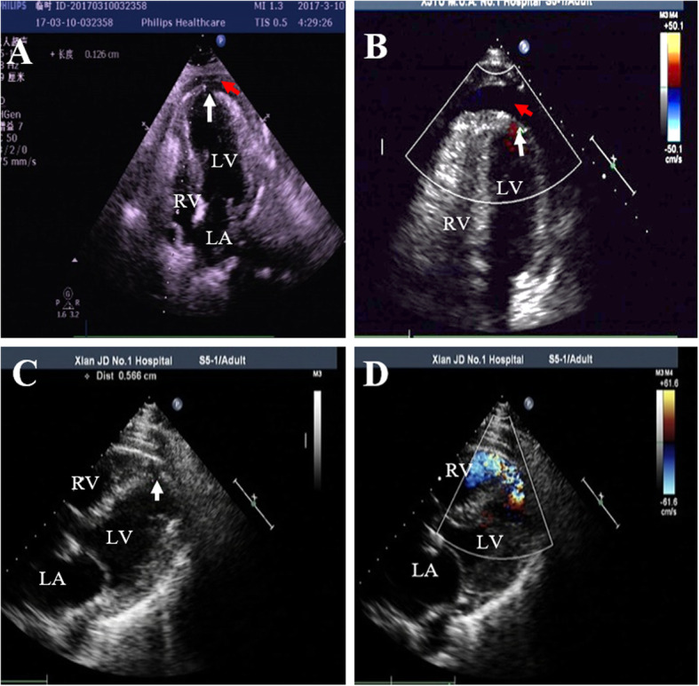 Fig. 1