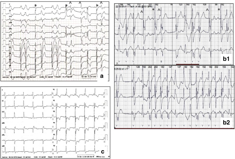 Fig. 2